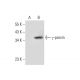 γ-parvin Antibody (D-6) - Western Blotting - Image 72459 
