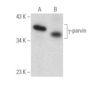 &gamma;-parvin Antibody (D-6) - Western Blotting - Image 389861 