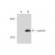 γ-parvin Antibody (F-9) - Western Blotting - Image 132707