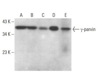 &gamma;-parvin Antibody (G-8) - Western Blotting - Image 376423 