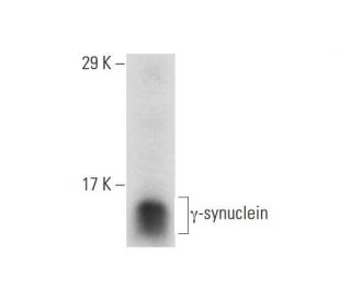 gamma Synuclein/SNCG Antibody (8H11) - Western Blotting - Image 133484 