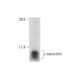 gamma Synuclein/SNCG Antibody (8H11) - Western Blotting - Image 133484 