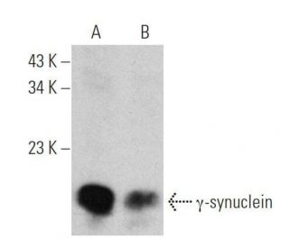 western blotting image from recommended gamma Synuclein/SNCG (1H10D2) monoclonal antibody replacement. Image 355291