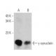 western blotting image from recommended gamma Synuclein/SNCG (1H10D2) monoclonal antibody replacement. Image 355291