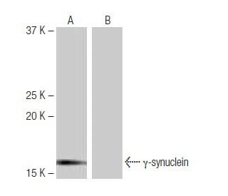 gamma Synuclein/SNCG Antibody (8H11) - Western Blotting - Image 65068Each CRISPR/Cas9 Knockout (KO) Plasmid product consists of a pool of 3 plasmids designed to ensure identification and cleavage of a specific gene for maximum knockout efficiency. Each plasmid encodes a unique 20 nt sequence derived from the GeCKO (v2) library.