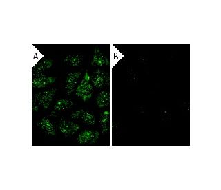 &gamma; Tubulin siRNA (h): sc-29322. Immunofluorescence staining of methanol-fixed, control HeLa (A) and &gamma; Tubulin s 