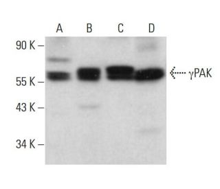 western blotting image from recommended &gamma;PAK (E-9) monoclonal antibody replacement. Image 381136