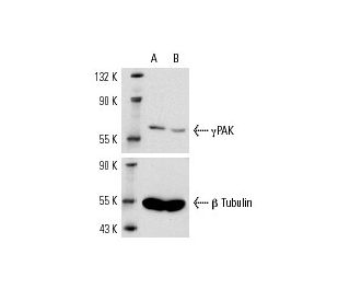 &gamma;PAK siRNA (m): sc-36184. Western blot analysis of &gamma;PAK expression in non-transfected control (A) and &gamma;P 