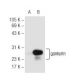 gankyrin Antibody (G-2) - Western Blotting - Image 68242 
