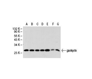 western blotting image from recommended gankyrin (3A6C2) monoclonal antibody replacement. Image 21340