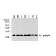 western blotting image from recommended gankyrin (3A6C2) monoclonal antibody replacement. Image 21340
