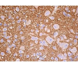 GAP-43 Antibody (B-5) - Immunohistochemistry - Image 387521