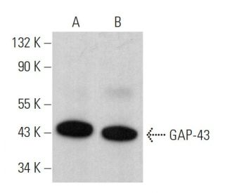 GAP-43 Antibody (7B10) - Western Blotting - Image 379430 