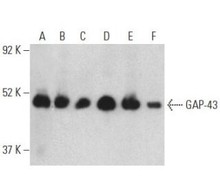 GAP-43 Antibody (7B10) - Western Blotting - Image 398863The Double Nickase Plasmid features a U6 promoter for sgRNA expression, a 20 nt targeting sequence, and a gRNA scaffold to guide Cas9n. It includes a CBh promoter for Cas9n (D10A) and puromycin resistance, GFP for transfection verification, and nuclear localization signals (NLS). The 2A peptide allows co-expression of Cas9n and Puro from a single promoter, enabling precise genome editing with reduced off-target effects.