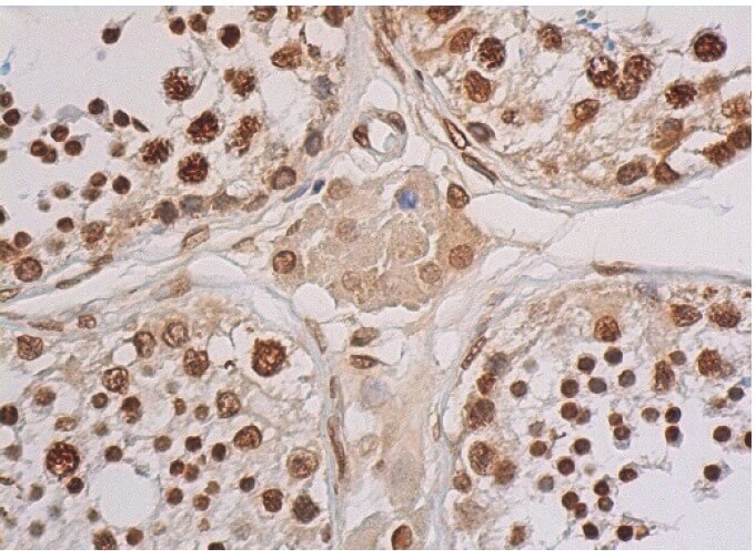 GAPDH Antibody (A-3) | SCBT - Santa Cruz Biotechnology