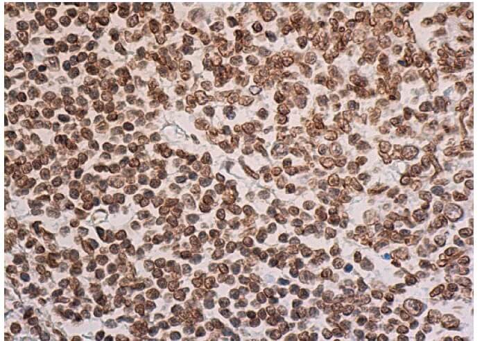 GAPDH Antibody (A-3) | SCBT - Santa Cruz Biotechnology