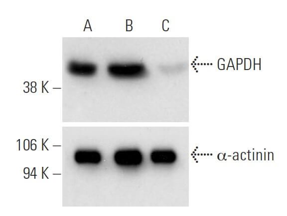 GAPDH siRNA h shRNA and Lentiviral Particle Gene Silencers