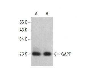 GAPT Antibody (B-6) - Western Blotting - Image 376389 
