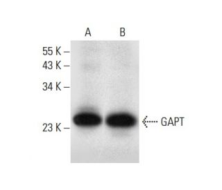 GAPT Antibody (H-8) - Western Blotting - Image 303475
