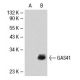 GAS41 Antibody (YEATB1A8) - Western Blotting - Image 19149 
