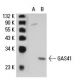 GAS41 Antibody (YEATB1A8) - Western Blotting - Image 19571