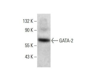 western blotting image from recommended GATA-2 (H-6) monoclonal antibody replacement. Image 351868