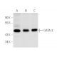 This polyclonal antibody has been discontinued. See our recommended <a href="gata-3-antibody-hg3-31">GATA3 (HG3-31)</a> monoclonal antibody (sample data shown). western blotting image from recommended GATA3 (HG3-31) monoclonal antibody replacement. Image 1175