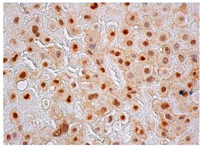 GATA3 Antibody (HG3-31) | SCBT - Santa Cruz Biotechnology