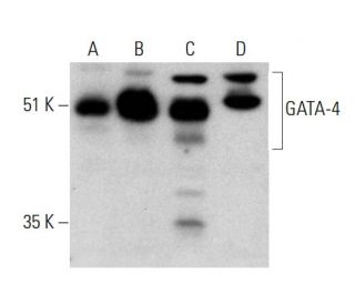 western blotting image from recommended GATA4 (G-4) monoclonal antibody replacement. Image 385201