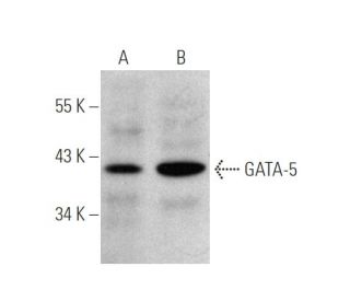 GATA-5 Antibody (A-3) - Western Blotting - Image 349278