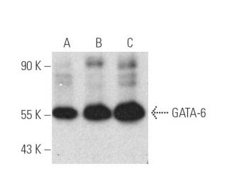 GATA-6 Antibody (3H3-H6-H11) - Western Blotting - Image 390990 