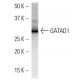 GATAD1 Antibody (GATA9A1D3) - Western Blotting - Image 16663 
