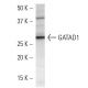 GATAD1 Antibody (GATA9A1D3) - Western Blotting - Image 16664 