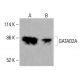 GATAD2A 抗体(G-9):sc-514987。对 K-562(A)和 HCT-116(B)完整细胞裂解物中 GATAD2A 的表达进行 Western blot 分析。使用的检测试剂:m-IgG Fc BP-HRP:sc-525409。 GATAD2A Antibody (G-9) - Western Blotting - Image 415851