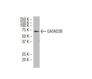 GATAD2B Antibody (ZZ-9) - Western Blotting - Image 34419