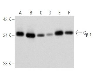 western blotting image from recommended Gβ 4 (F-3) monoclonal antibody replacement. Image 354827