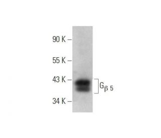 G<sub>&beta;</sub><sub> 5 Antibody (</sub>F-5) - Western Blotting - Image 353431 