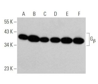 G<sub>&beta; Antibody (</sub>B-11) - Western Blotting - Image 356270 