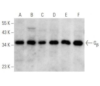 G<sub>&beta;</sub><sub> Antibody (</sub>F-8) - Western Blotting - Image 354707 