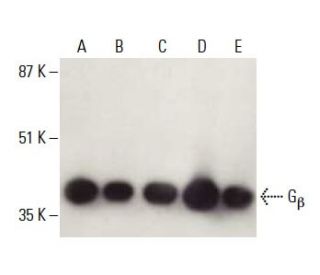 G Antibody H 1 SCBT Santa Cruz Biotechnology