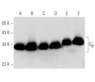 Anti Gb Antibody H 1 Scbt Santa Cruz Biotechnology