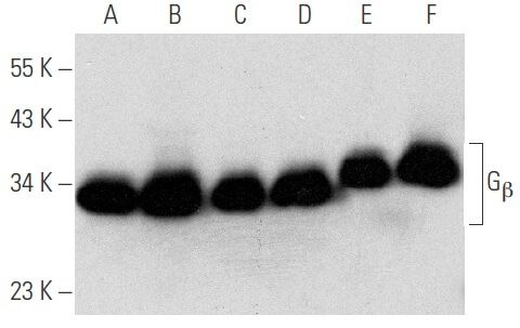 Gβ Antibody (H-1) | SCBT - Santa Cruz Biotechnology