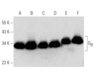 western blotting image from recommended Gβ (H-1) monoclonal antibody replacement. Image 354708