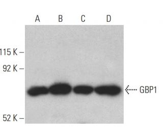 GBP1 Antibody (1B1) - Western Blotting - Image 399501
