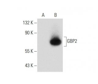 GBP2 Antibody (G-9) - Western Blotting - Image 133981