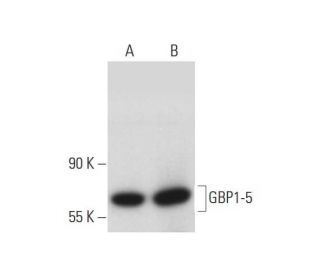 GBP1-5 Antibody (G-12) - Western Blotting - Image 127968