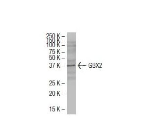 GBX2 Antibody (BB-9) - Western Blotting - Image 33613The Double Nickase Plasmid features a U6 promoter for sgRNA expression, a 20 nt targeting sequence, and a gRNA scaffold to guide Cas9n. It includes a CBh promoter for Cas9n (D10A) and puromycin resistance, GFP for transfection verification, and nuclear localization signals (NLS). The 2A peptide allows co-expression of Cas9n and Puro from a single promoter, enabling precise genome editing with reduced off-target effects.