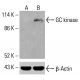 Anticorpo GC chinasi (A-10): sc-398967. Analisi Western blot dell'espressione della GC chinasi in lisati cellulari interi HCT-116 non trattati (A) e trattati chimicamente (B). β-Actina (C4): sc-47778 utilizzato come controllo di caricamento. Reagente di rilevamento utilizzato: m-IgG Fc BP-HRP: sc-525409. GC kinase Antibody (A-10) - Western Blotting - Image 415568
