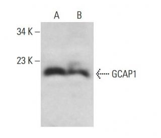 GCAP1 Antibody (E-5) - Western Blotting - Image 376115 
