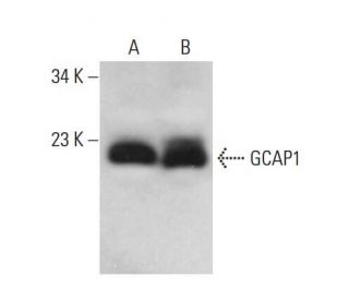 GCAP1 Antibody (F-6) - Western Blotting - Image 376116 